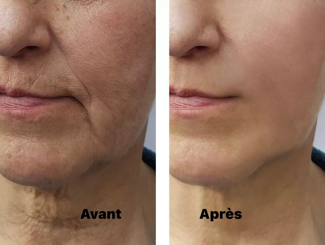 Revitalift soin anti rides instantané