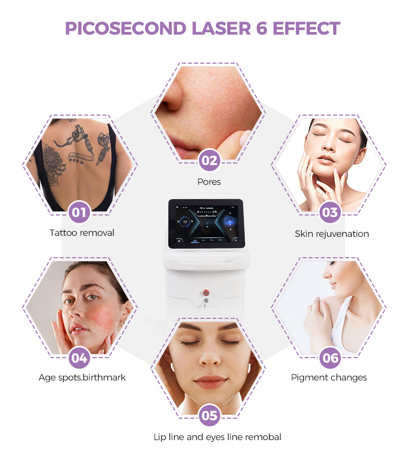 Laser pico vs Q-switched