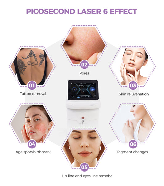 Laser pico vs Q-switched